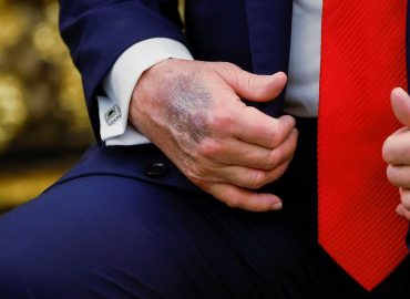 Sanewashing und die Berichterstattung über Donald Trump