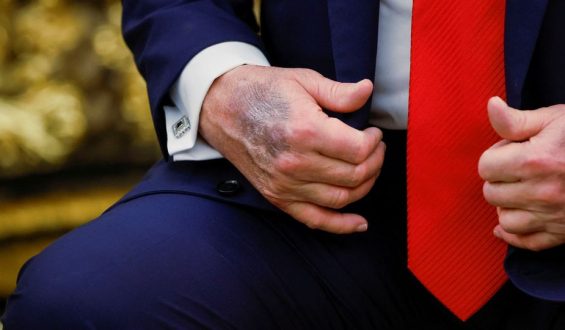 Sanewashing und die Berichterstattung über Donald Trump