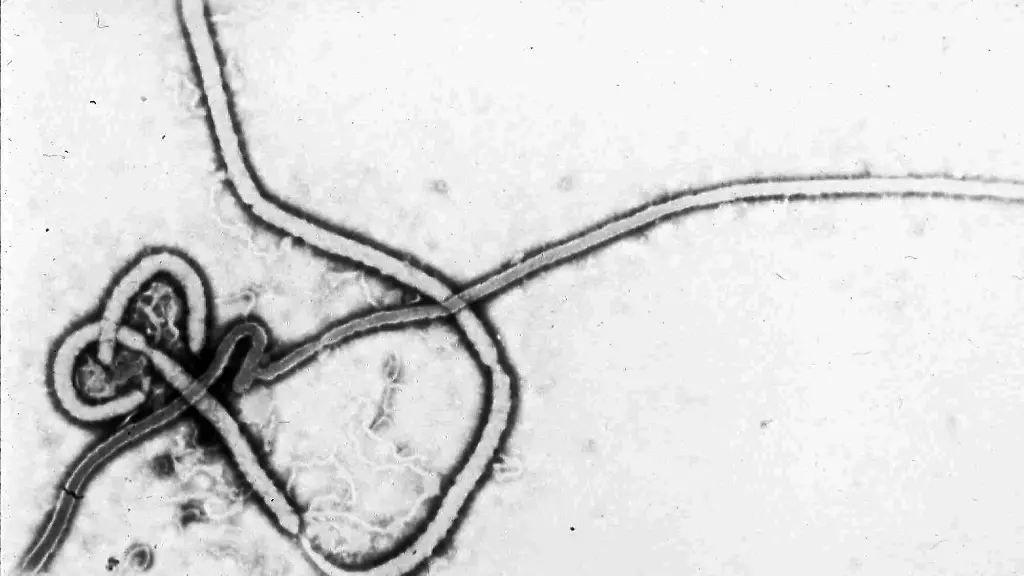 Das Ebolavirus: Ursprung, Übertragung und Maßnahmen