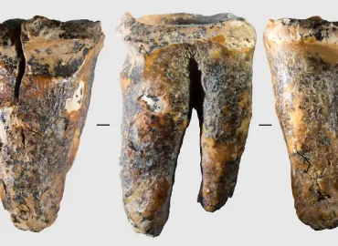 Neandertaler und die Anfänge der Zahnmedizin
