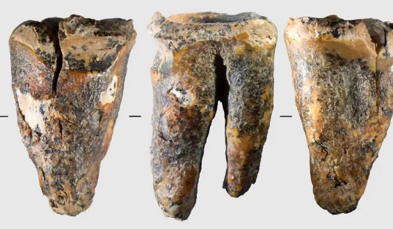 Neandertaler und die Anfänge der Zahnmedizin