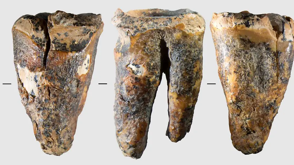 Neandertaler und die Anfänge der Zahnmedizin