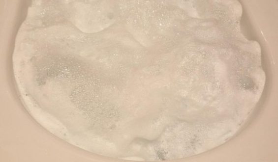 Effektive WC-Reinigung mit Toilettenschaum im Test