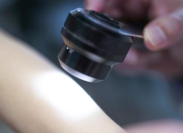 mRNA-Impfung gegen Hautkrebs zeigt langfristige Wirkung