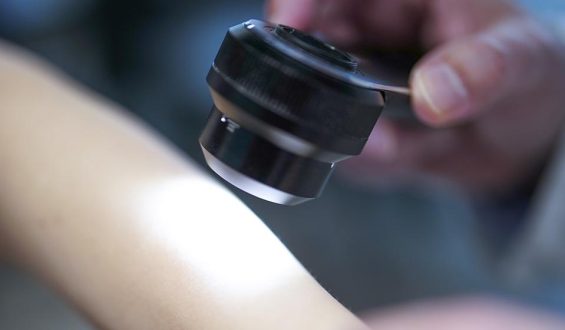 mRNA-Impfung gegen Hautkrebs zeigt langfristige Wirkung