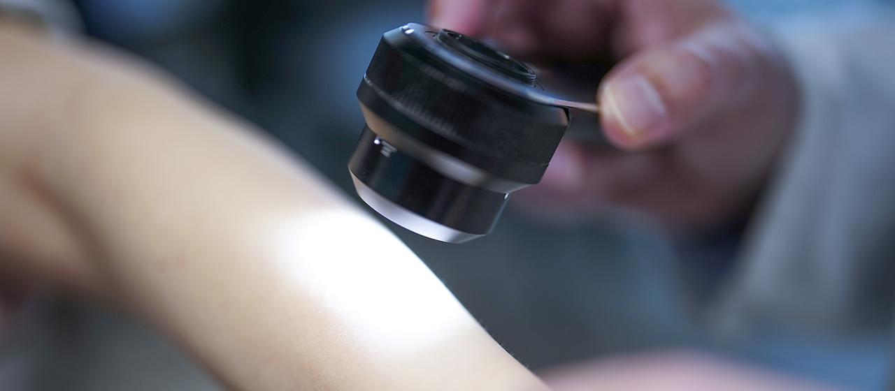 mRNA-Impfung gegen Hautkrebs zeigt langfristige Wirkung