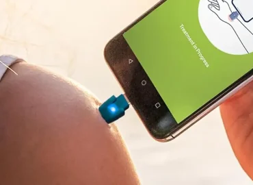 Effektive Hilfe bei Mückenstichen: Der Heat-it-Stichheiler am Prime Day reduziert