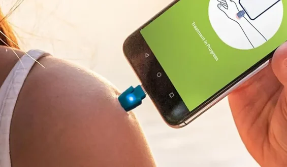 Effektive Hilfe bei Mückenstichen: Der Heat-it-Stichheiler am Prime Day reduziert
