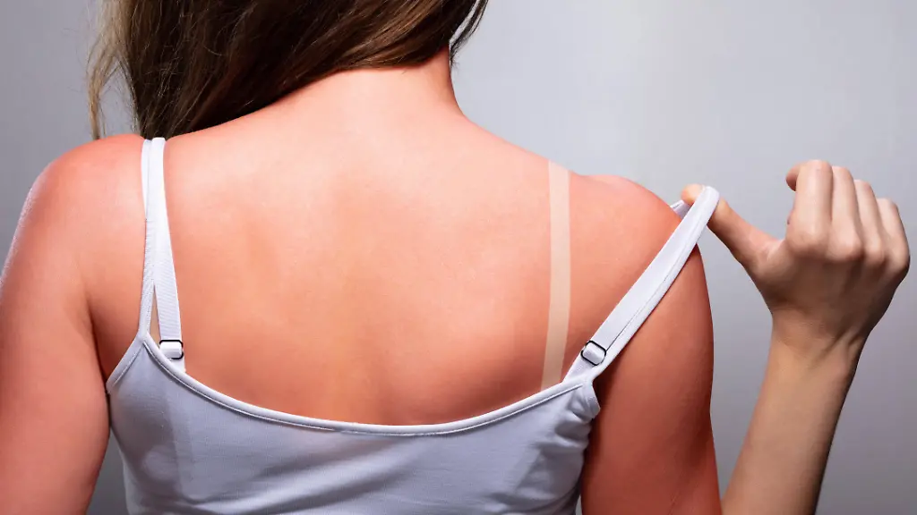 „Tanmaxxing“: Gefährlicher Trend und seine Gesundheitsrisiken