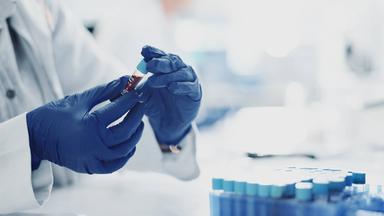 Leben nach der Sepsis: Herausforderungen und Unterstützung