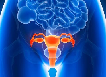 Verständnis der Endometriose: Aufklärung durch eine Frauenärztin